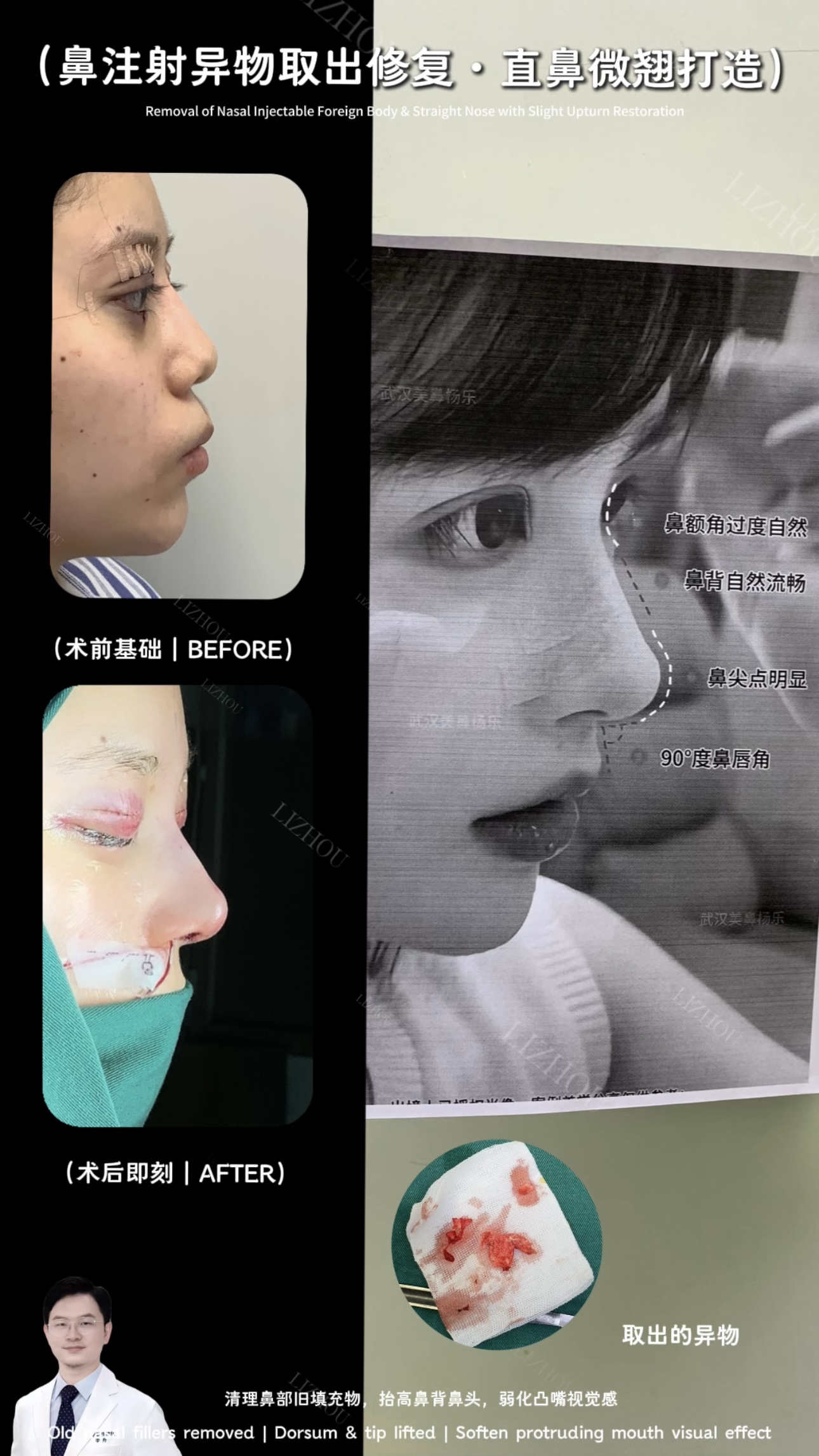 Case 01