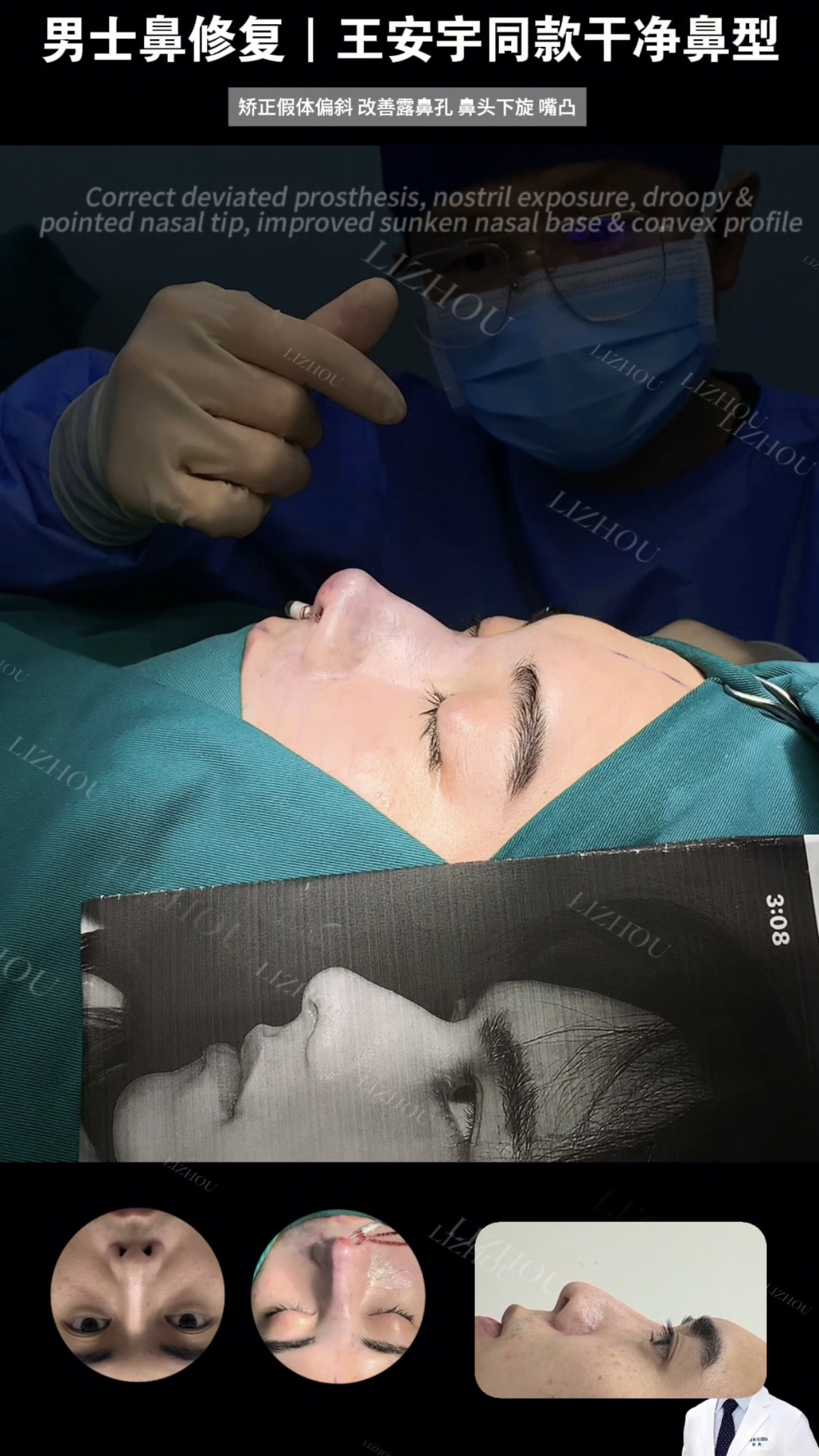 Case 15