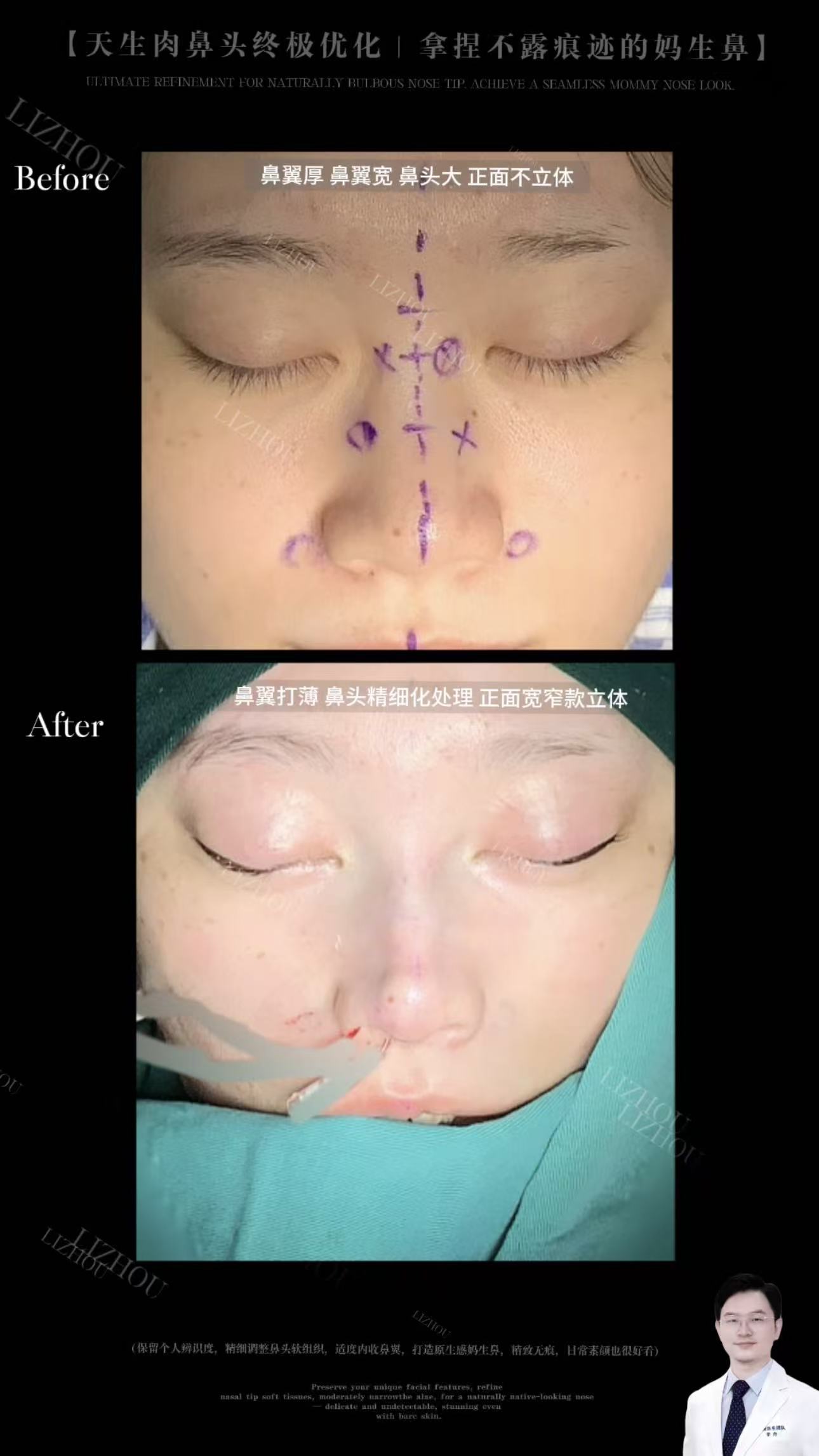 Case 16